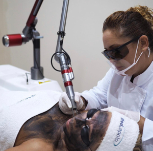 Sistema laser Nd Yag Q-Switched